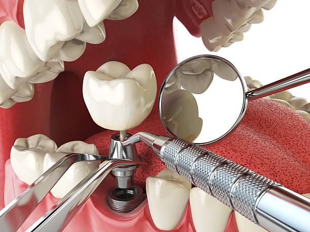 Best Emergency TMJ Treatment in Redland, AL